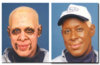 4348415vitiligo2.jpg